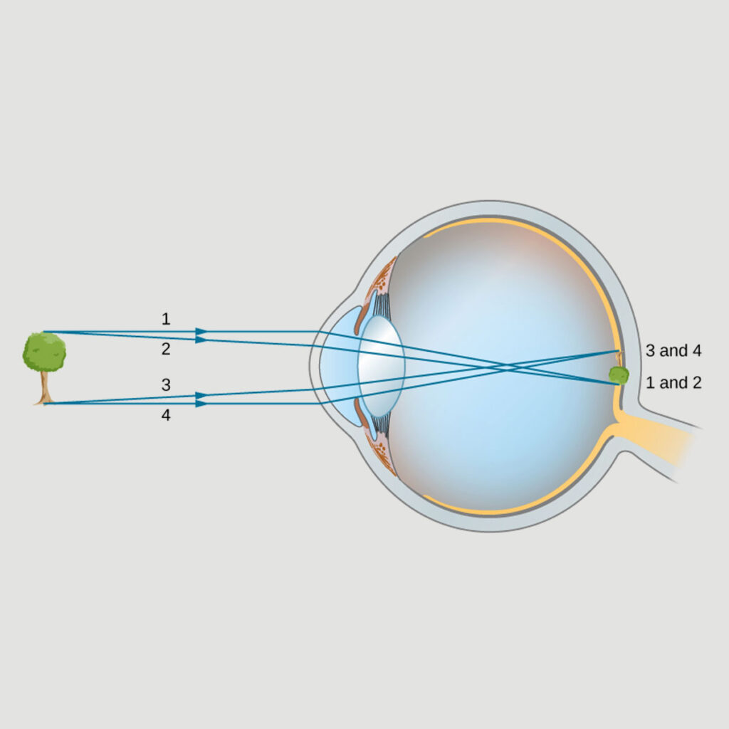 refraction-and-eye-part-3-experihub-learning